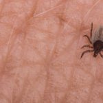 Síndrome alfa-gal: la extraña alergia a la carne por una picadura de garrapata