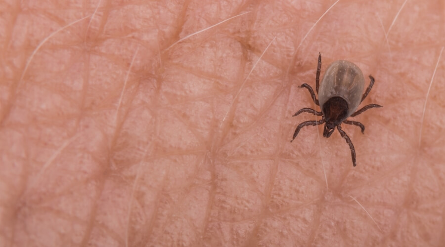 Síndrome alfa-gal: la extraña alergia a la carne por una picadura de garrapata